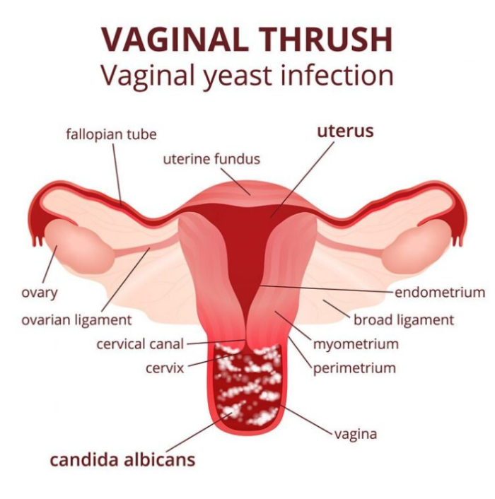 URIFECT & VSL# Balance - A "Candida-csomag" - Image 6